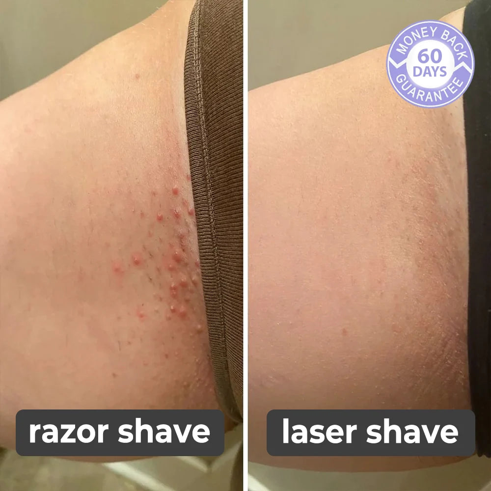 Lumishave™️