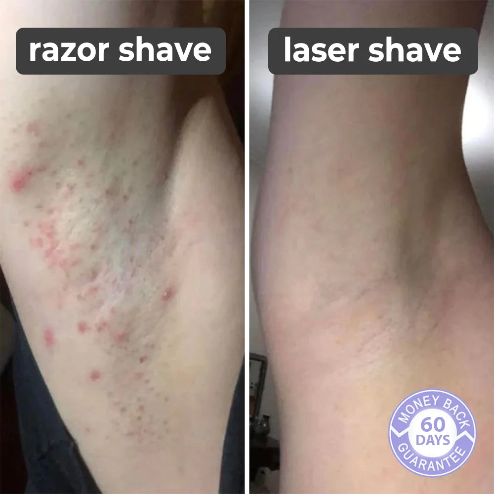 Lumishave™️